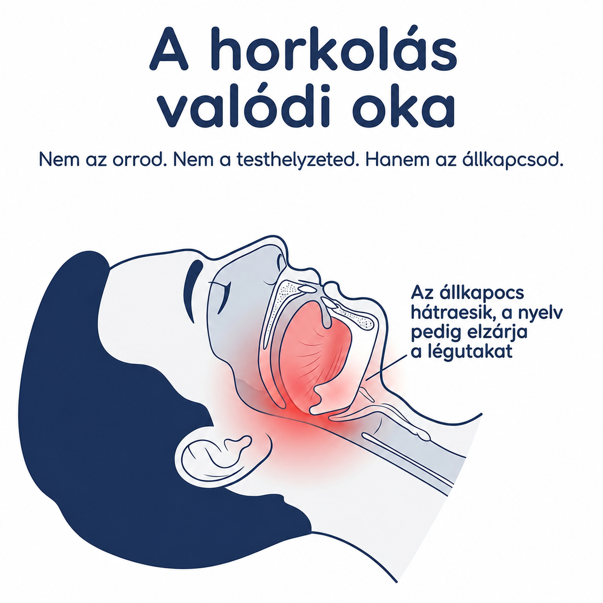 „Szüntesd meg a horkolást már az első éjszakától – VitaNocta (+ AJÁNDÉK TOK)